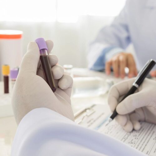 Doctor holding a bottle of blood sample in lab. science and medical concept